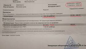 Макропролактин менее 40%: что это значит в Техносила